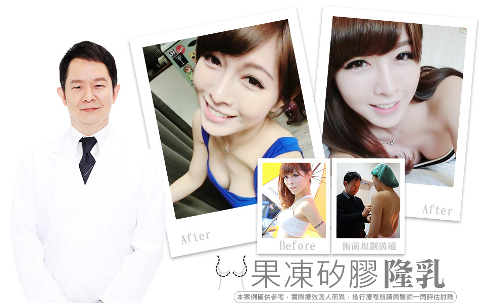 果凍矽膠水滴型隆乳
