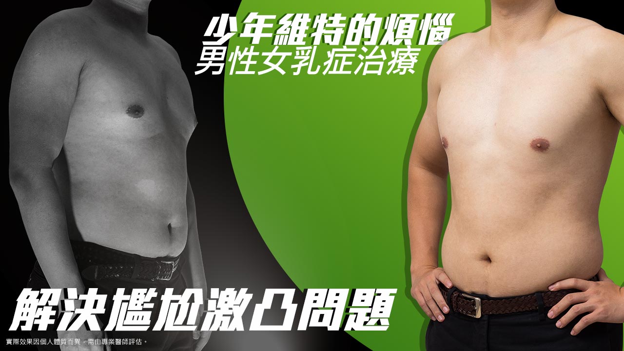 肌膚老化