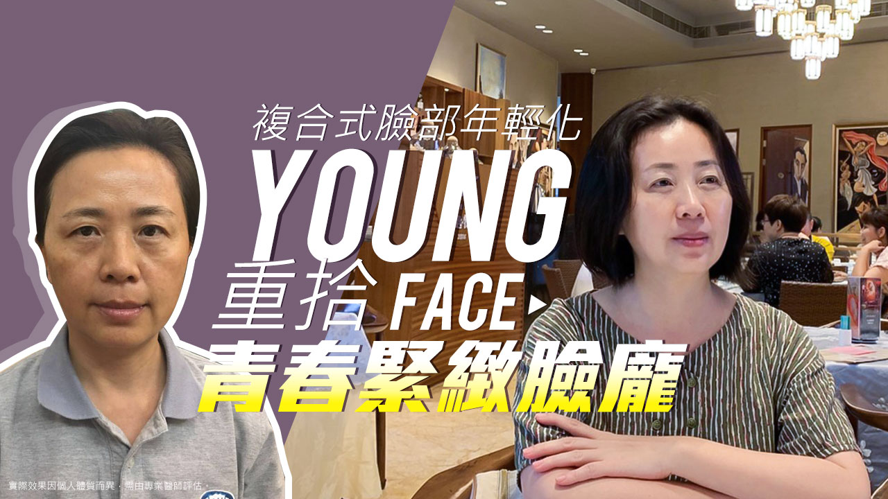 微創五爪八爪前額內視鏡拉皮手術