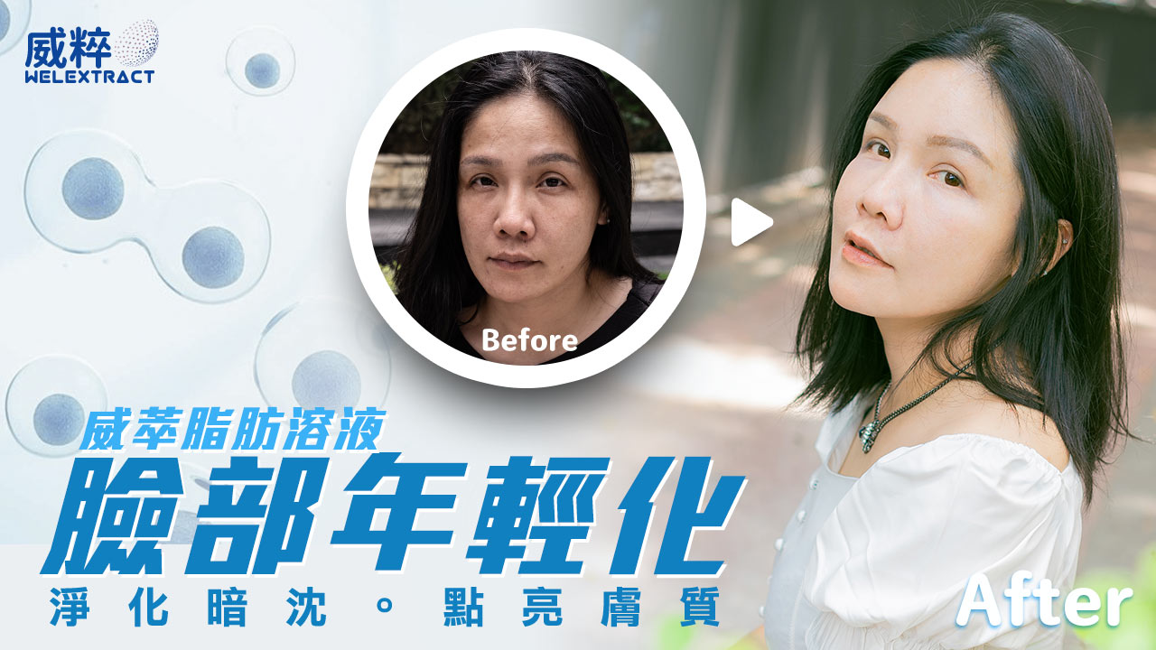 威萃脂肪溶液