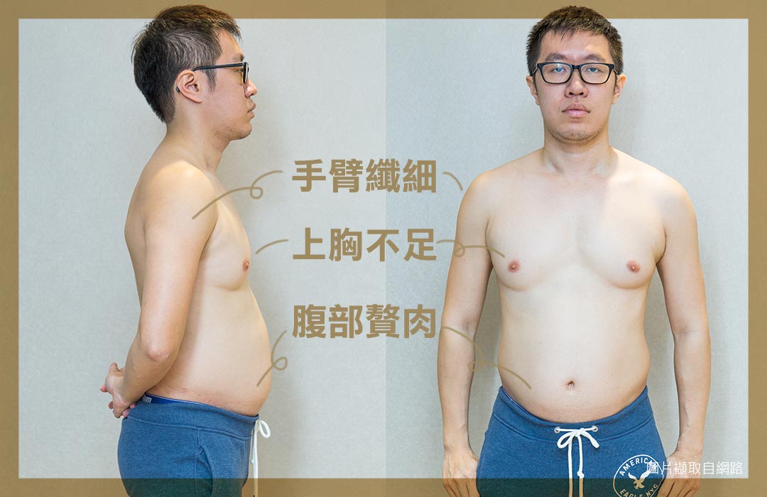 周爾康醫師威塑抽脂體態雕塑六塊肌案例術前-08-06