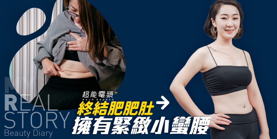 超能電漿腹部緊實拉皮心得分享