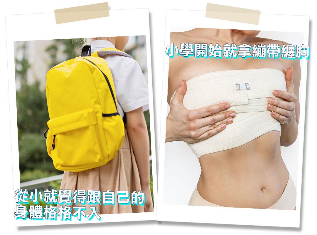 平胸手術分享心得｜平胸手術推薦｜甜甜圈式平胸手術｜台中平胸手術推薦診所