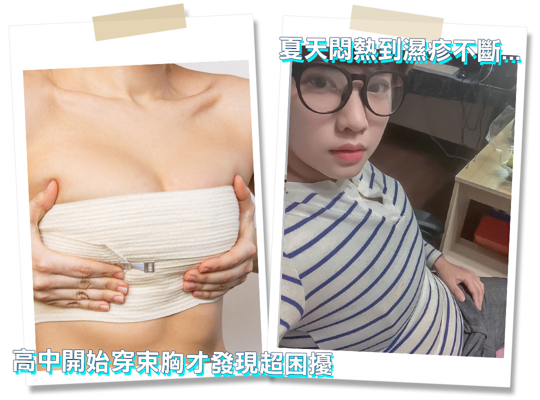 平胸手術分享心得｜平胸手術推薦｜甜甜圈式平胸手術｜台中平胸手術推薦診所