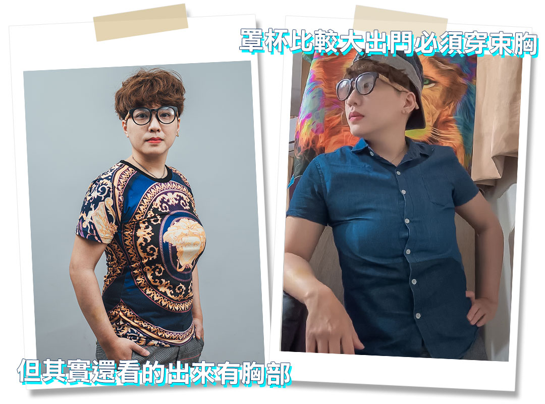平胸手術分享心得｜平胸手術推薦｜甜甜圈式平胸手術｜台中平胸手術推薦診所
