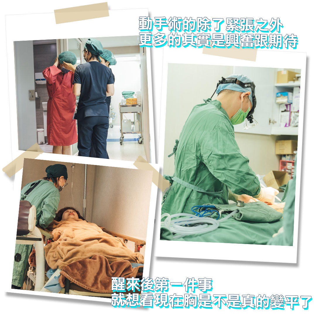 平胸手術分享心得｜平胸手術推薦｜甜甜圈式平胸手術｜台中平胸手術推薦診所