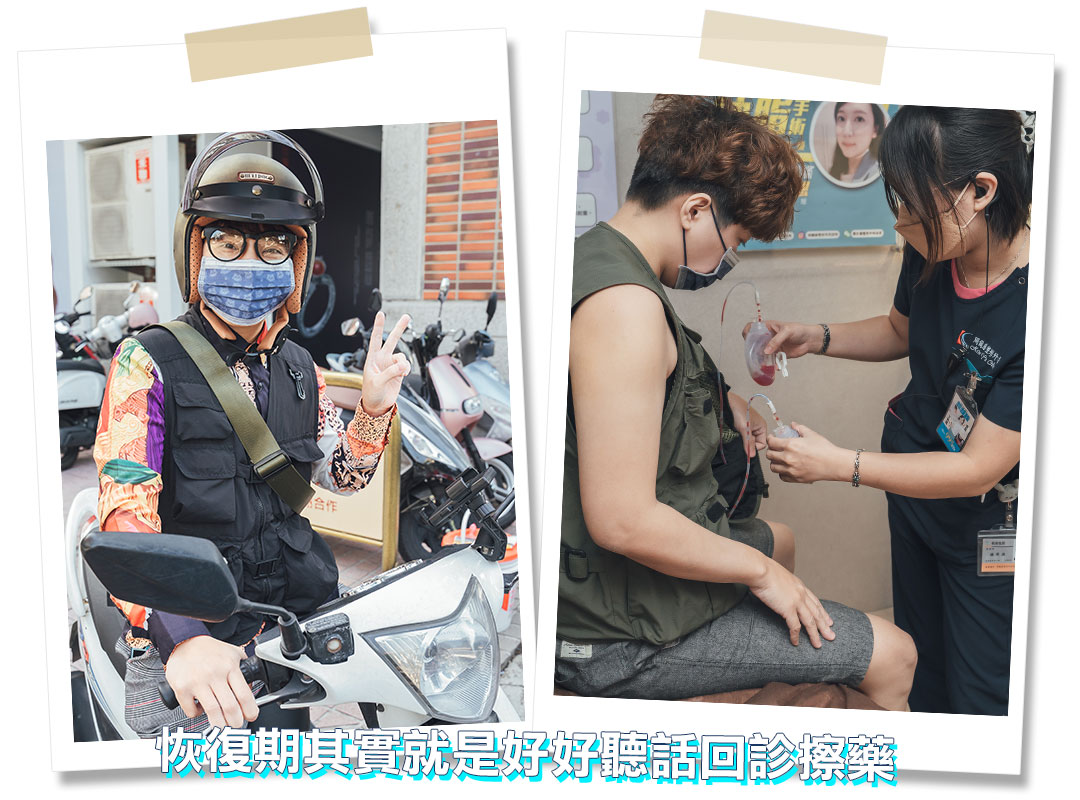 平胸手術分享心得｜平胸手術推薦｜甜甜圈式平胸手術｜台中平胸手術推薦診所