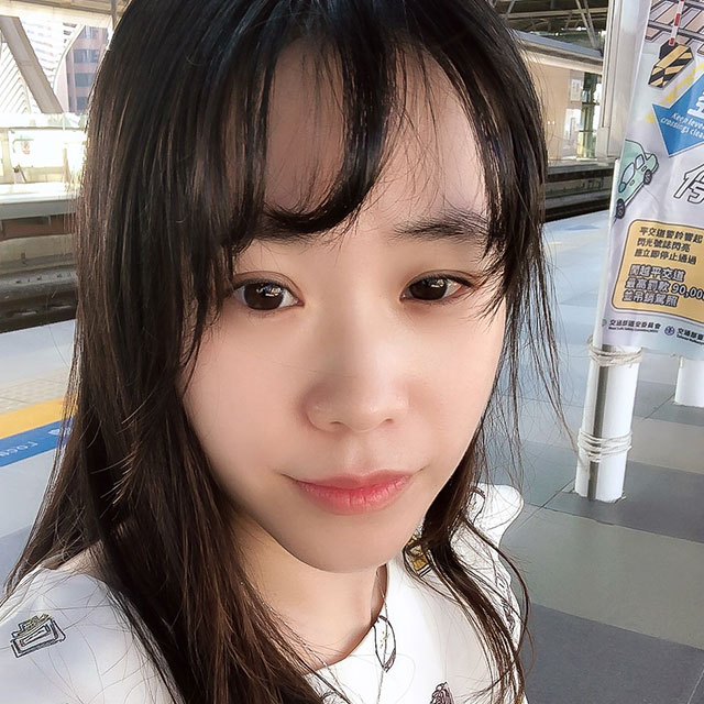 瘦小臉案例-口內取脂/墊下巴