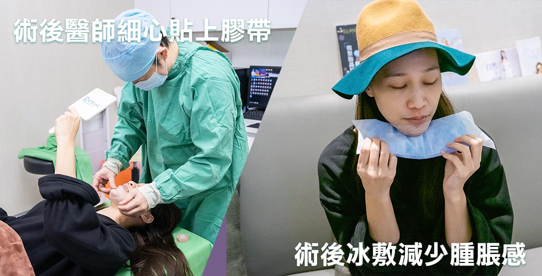 打造精緻臉龐-墊下巴手術