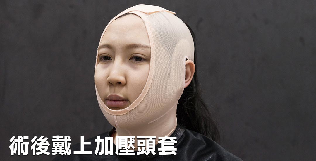 擺脫雙下巴。擁有迷人下顎線條
