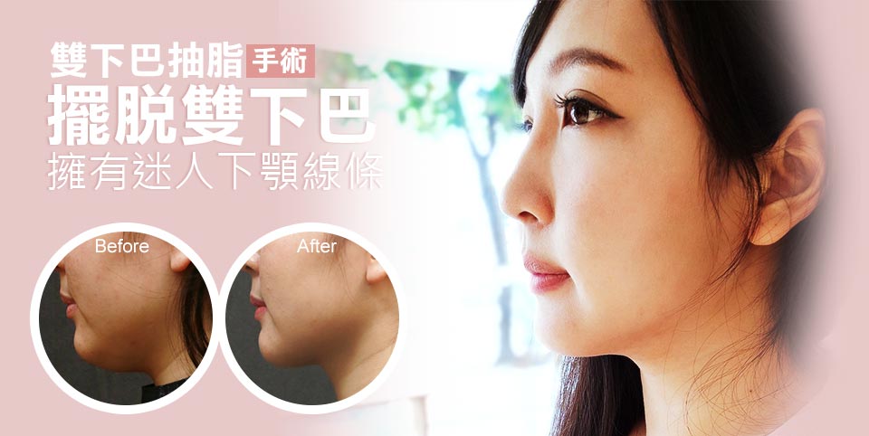 擺脫雙下巴。擁有迷人下顎線條