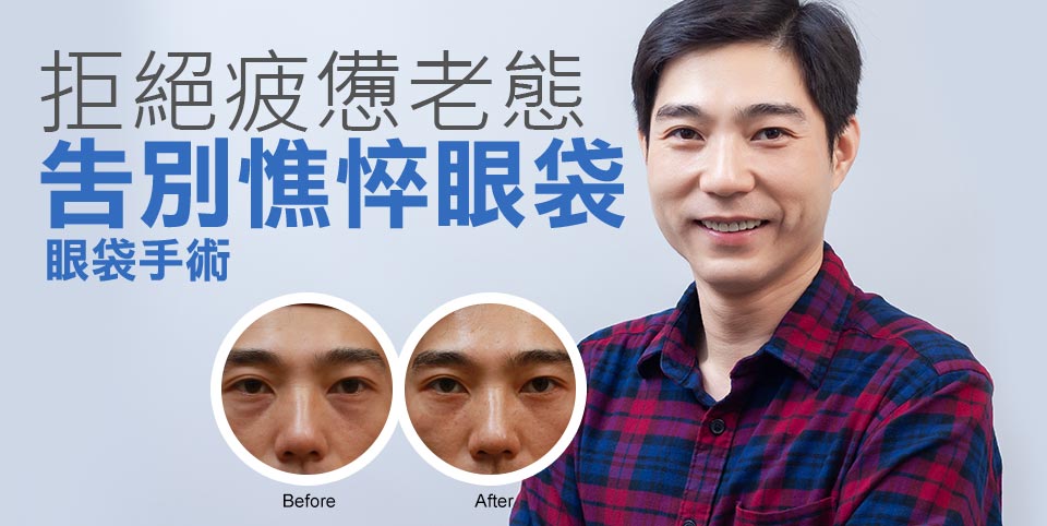 拒絕疲憊老態。告別憔悴眼袋