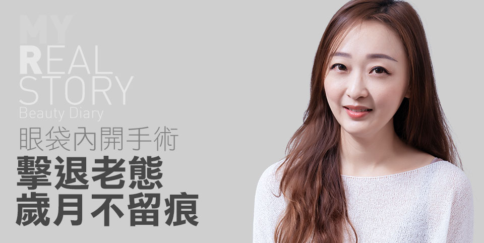 眼袋手術心得分享