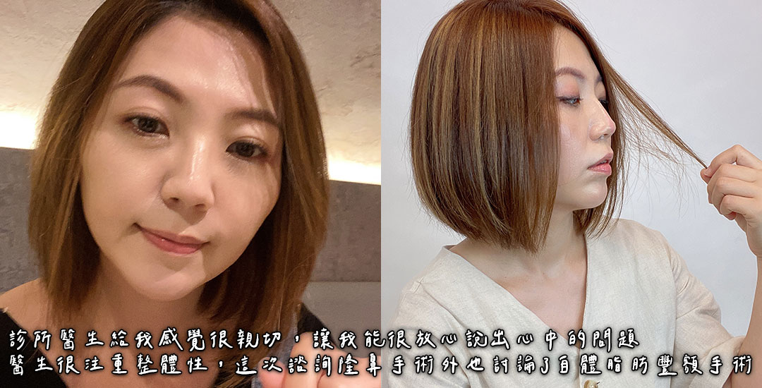 隆鼻/臉部精雕手術打造混血臉龐心得分享
