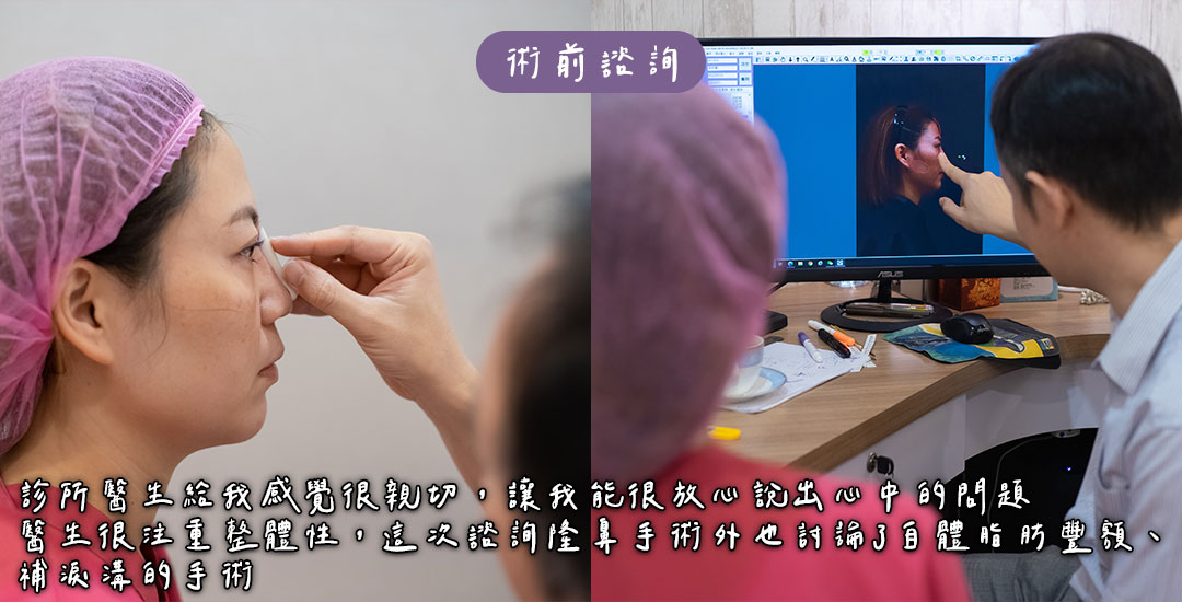 隆鼻/臉部精雕手術打造混血臉龐心得分享