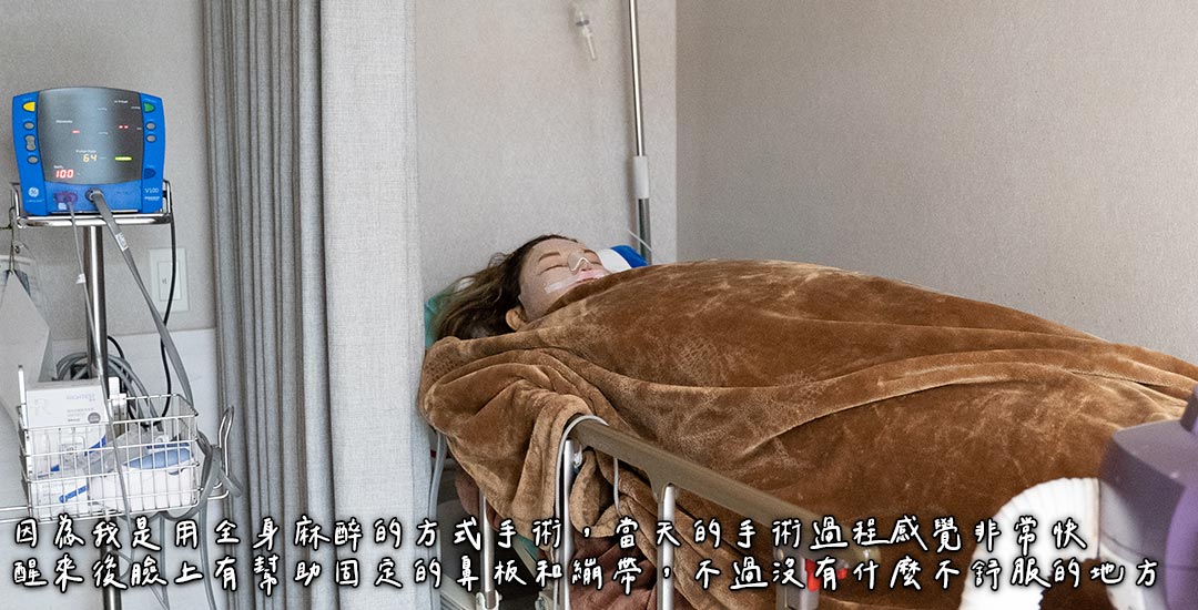 隆鼻/臉部精雕手術打造混血臉龐心得分享