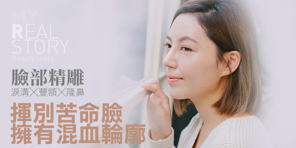 隆鼻/臉部精雕手術打造混血臉龐心得分享