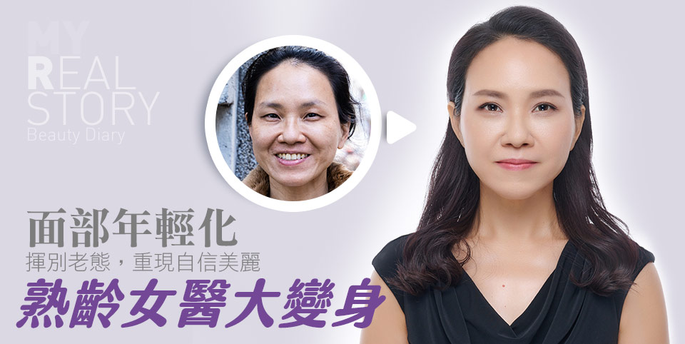 臉部整形面部年輕化熟齡女醫大變身揮別老態重現自信美麗