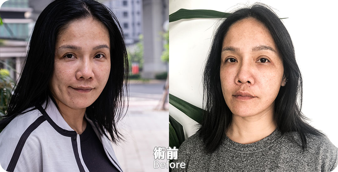 威萃脂肪溶液解放肌膚再生之力