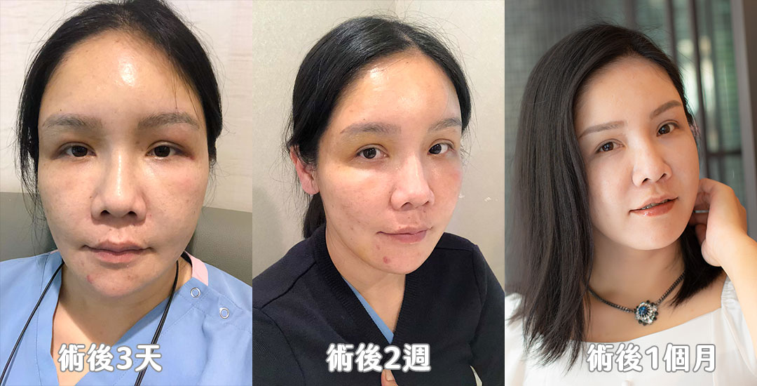威萃脂肪溶液解放肌膚再生之力