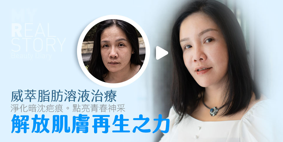威萃脂肪溶液解放肌膚再生之力