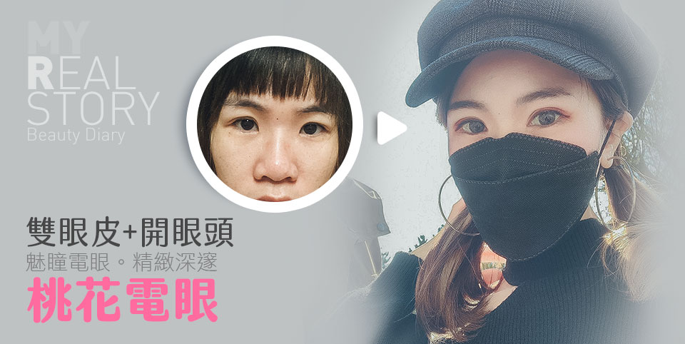 雙眼皮+開眼頭|桃花電眼|魅瞳電眼|精緻深邃
