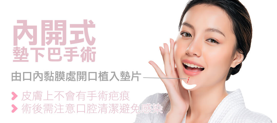 內開式墊下巴整形手術說明