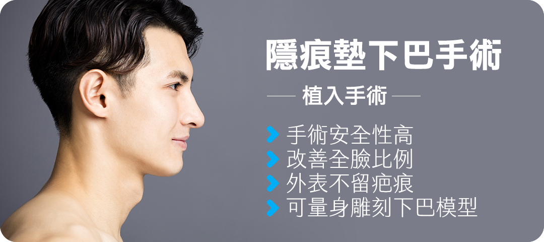 隱痕墊下巴手術-手術優點