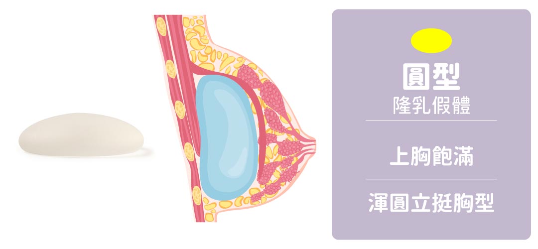 隆乳假體形狀|圓形隆乳假體 隆乳假體形狀|圓形隆乳假體