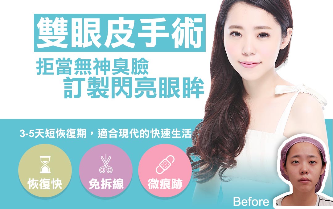 台中雙眼皮推薦。隱痕縫雙眼皮首選