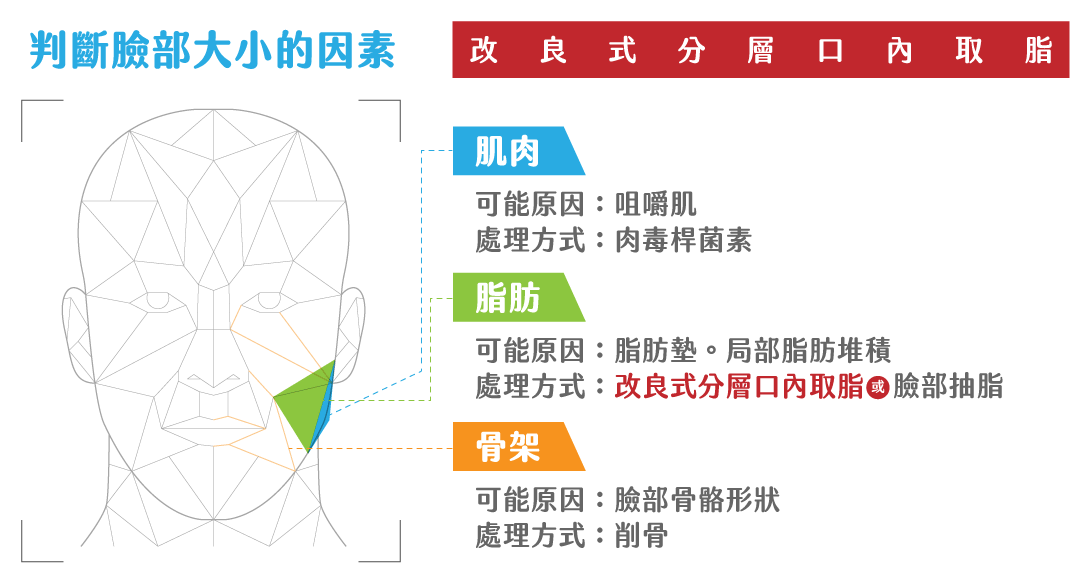 口內取脂,消除嬰兒肥臉型|重回V字臉