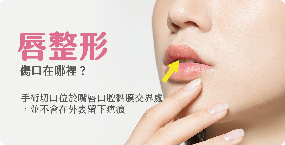 唇型手術介紹