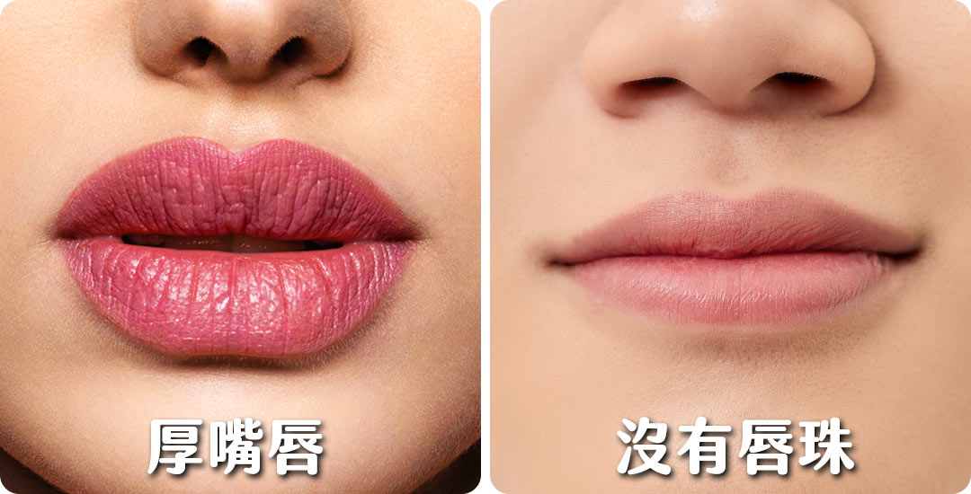 唇型手術介紹