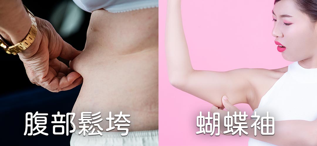 鳳凰電波改善臉部鬆弛與皺紋,臉部拉提保養有效治療鬆弛,讓肌膚擁有由內而外的緊緻美麗