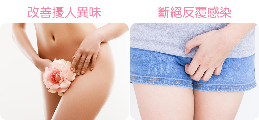 私密處整形/小陰唇手術治療(改善惱人異味/斷絕反覆感染)