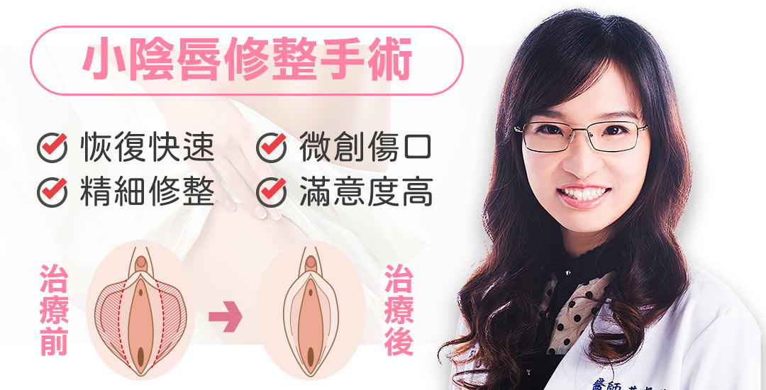 台中私密處整形手術｜一線鮑手術｜小陰唇手術｜女醫執刀｜小陰唇過長｜陰唇整形手術