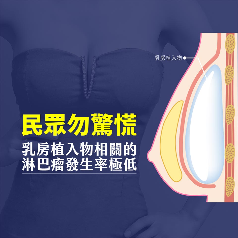 乳房植入物相關的淋巴瘤發生率極低,民眾勿驚慌