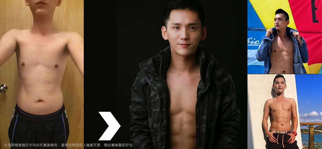 男性胸肌終極雕塑術。為你塑造男人該有的完美胸肌體態